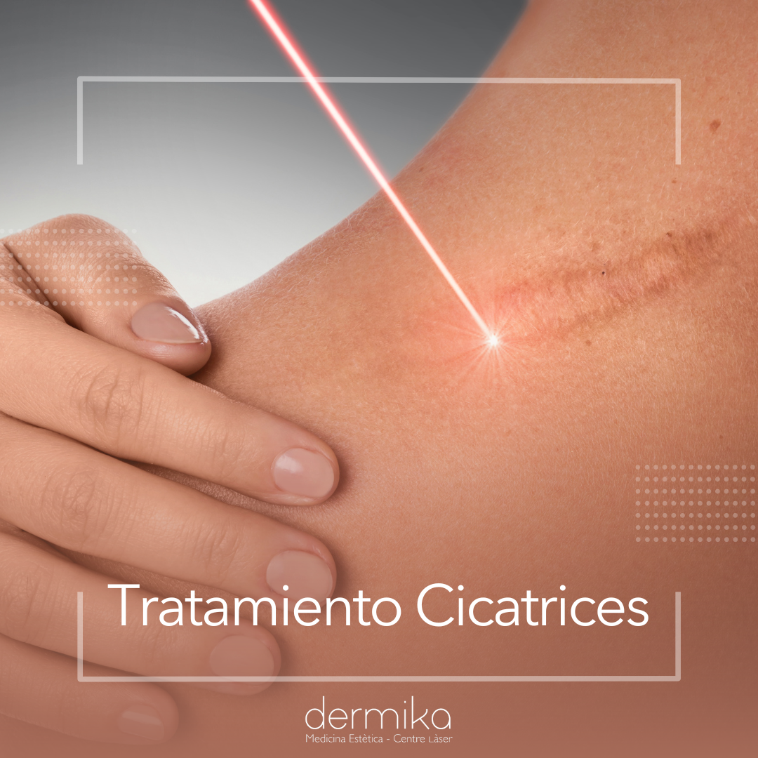 Tratamiento Cicatrices
