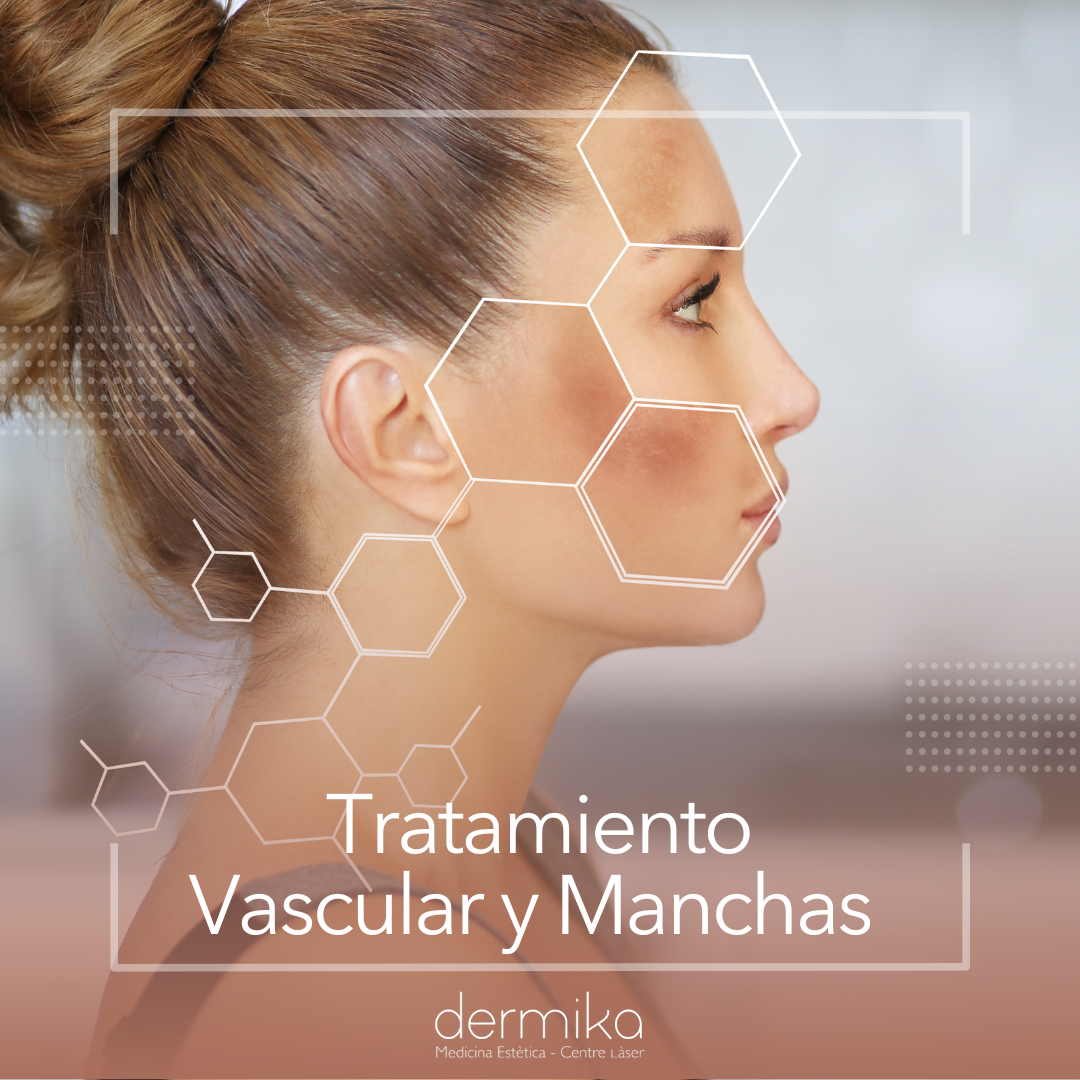Manchas y Vascular